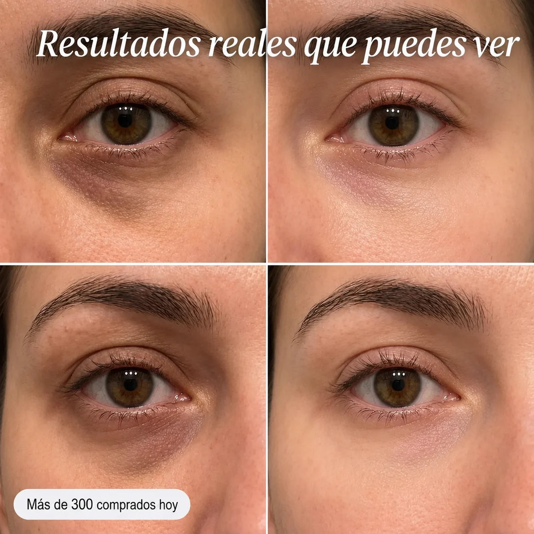 Bálsamo voluminizador con pdrn para las arrugas