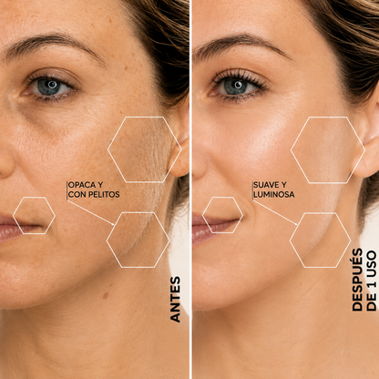 Pulidor facial sonico- La mejor herramienta de dermaplaning de el mercado